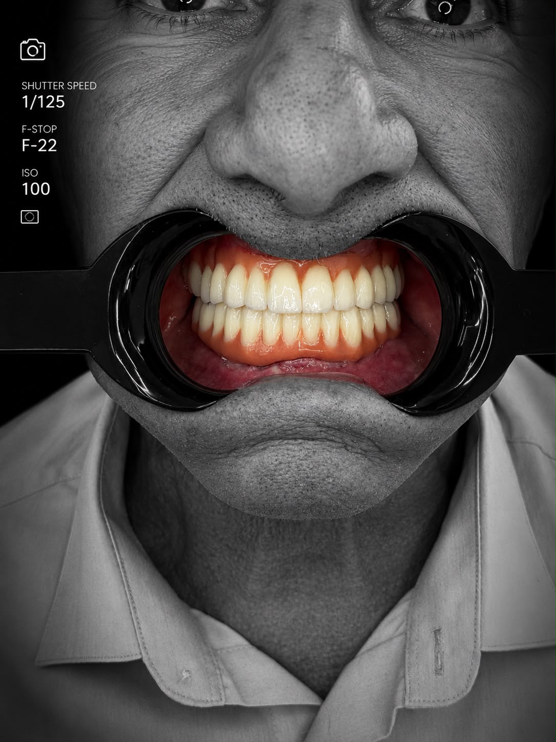 Full set of restored teeth, clinical view